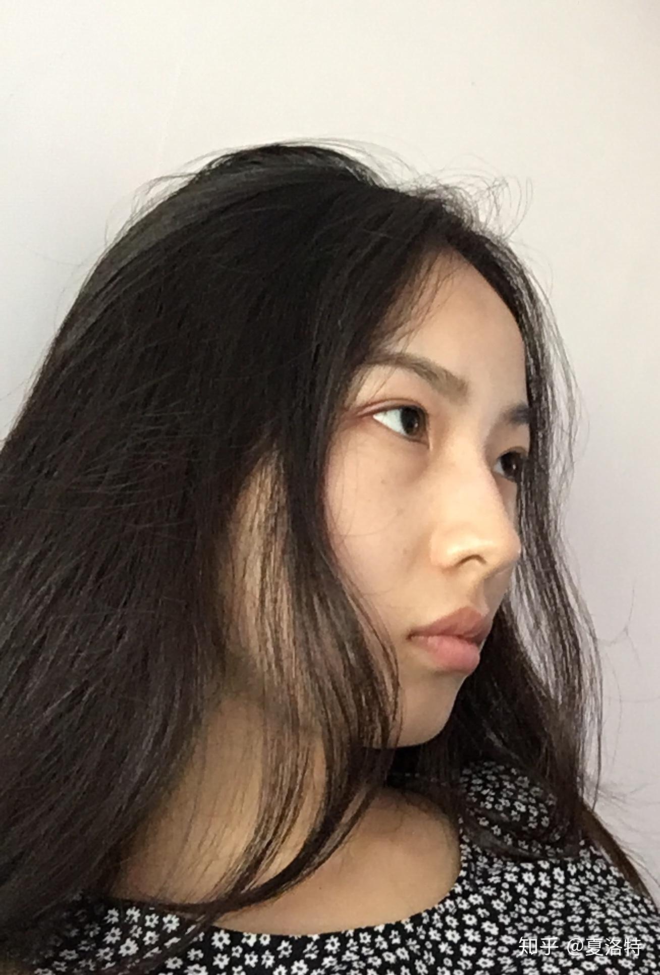 鼻子太挺拔有什么体验