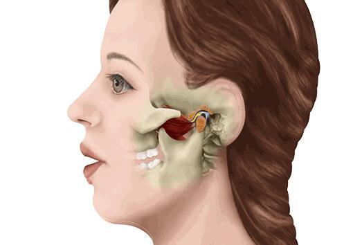 嘴巴一边张不开是怎么回事?