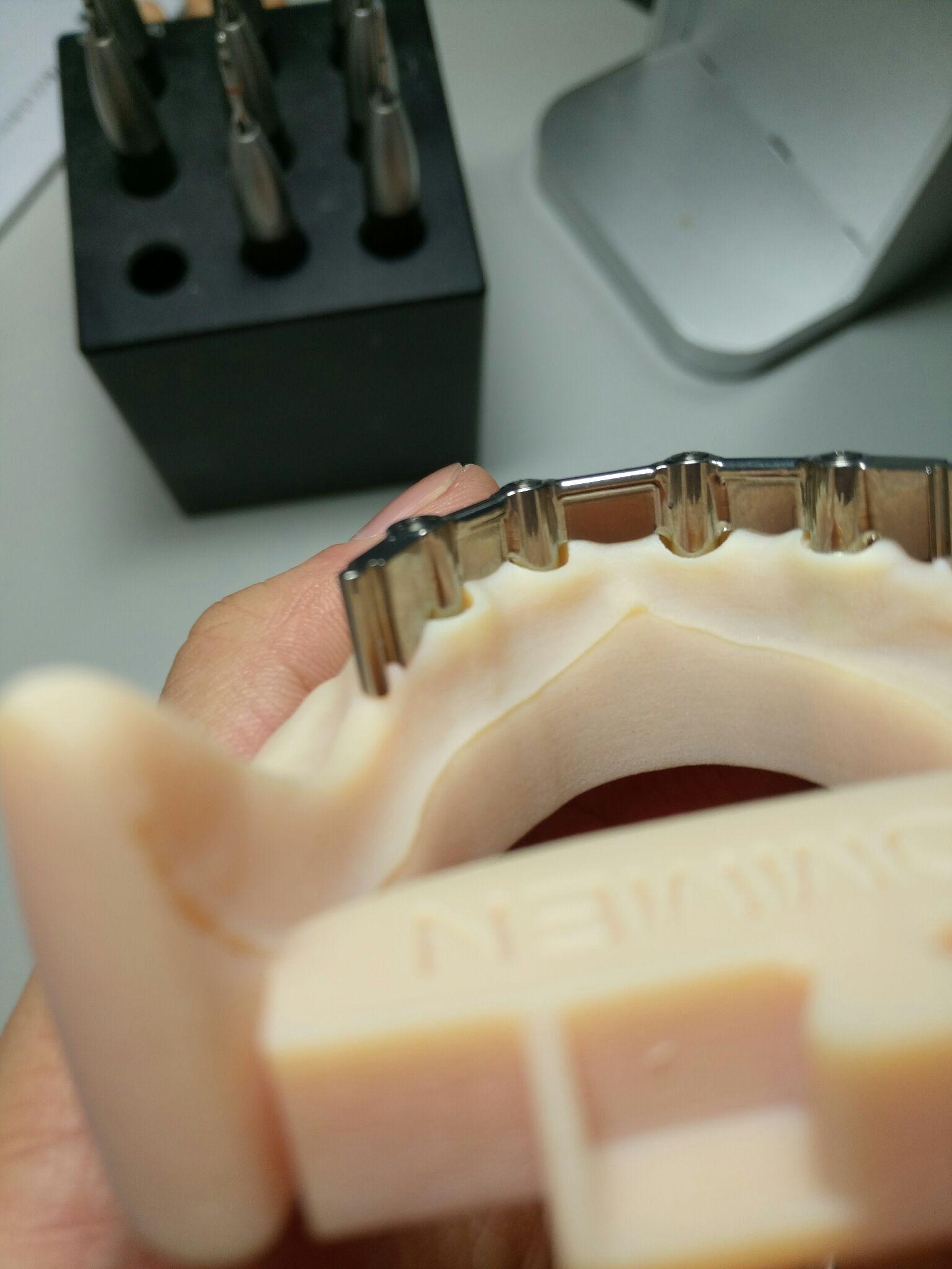 3shape口内扫描是否口腔领域的趋势