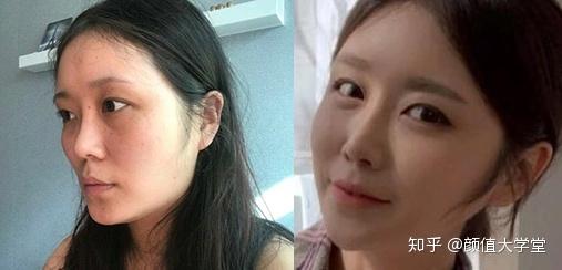 小松菜奈恋情曝光 厌世脸 为何能收割日韩两大男神 知乎 小松菜奈恋情曝光 厌世脸 为何能收割日韩两大男神 知乎