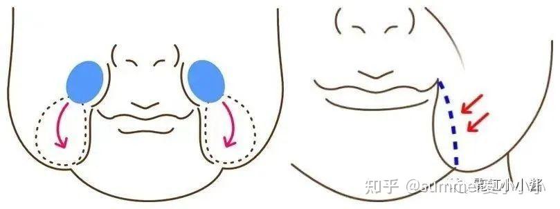 冻龄秘籍!全年龄皮相抗衰终极攻略 |日本医美 - 知乎