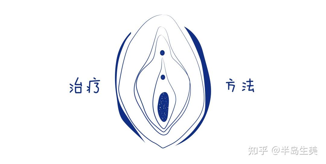 可以试试这个办法! - 知乎