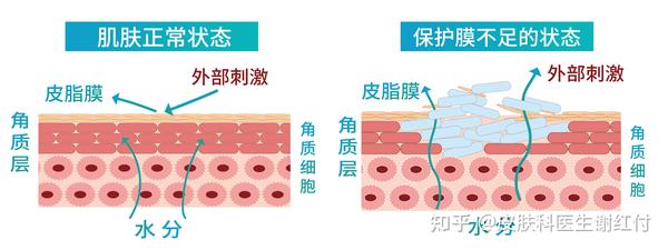 总是说皮肤屏障受损，你真的了解皮肤屏障吗？ - 知乎