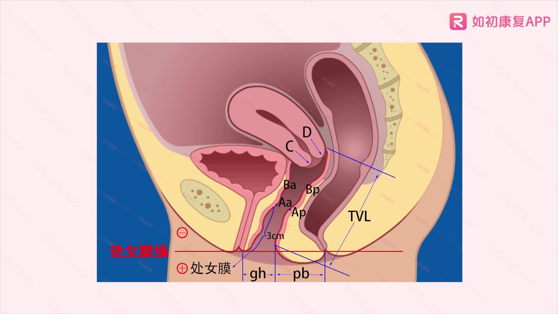 产后胸部下垂,提内脏下垂,脱肛,胃下垂,子宫脱垂,肾下垂等