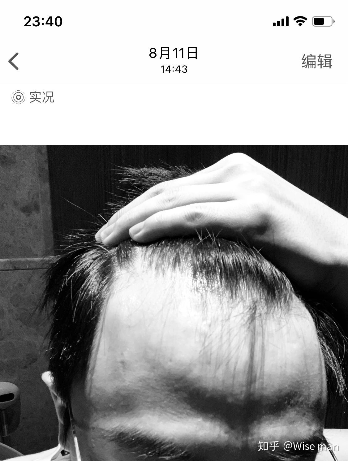 秃头的男人抬起头，抓着头发照片摄影图片_ID:168280970-Veer图库