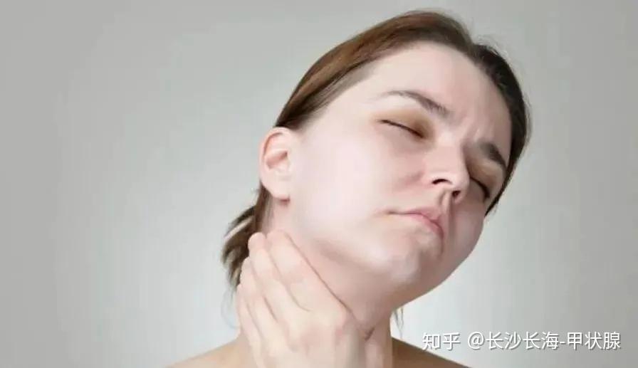 甲亢疾病有哪些常见症状? - 知乎