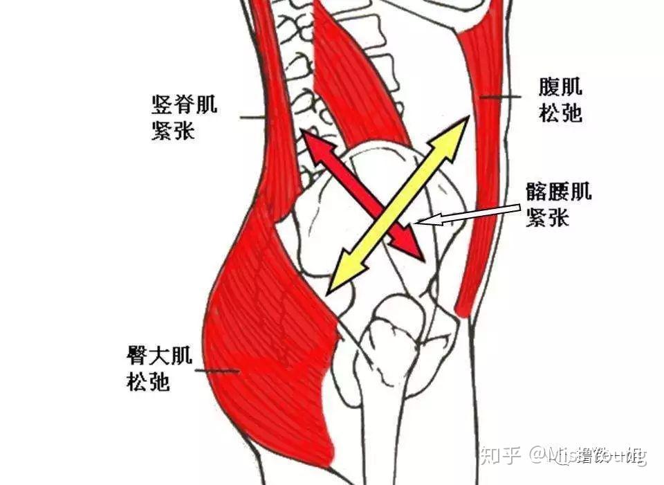 什么是「肌肉代偿」? - 知乎