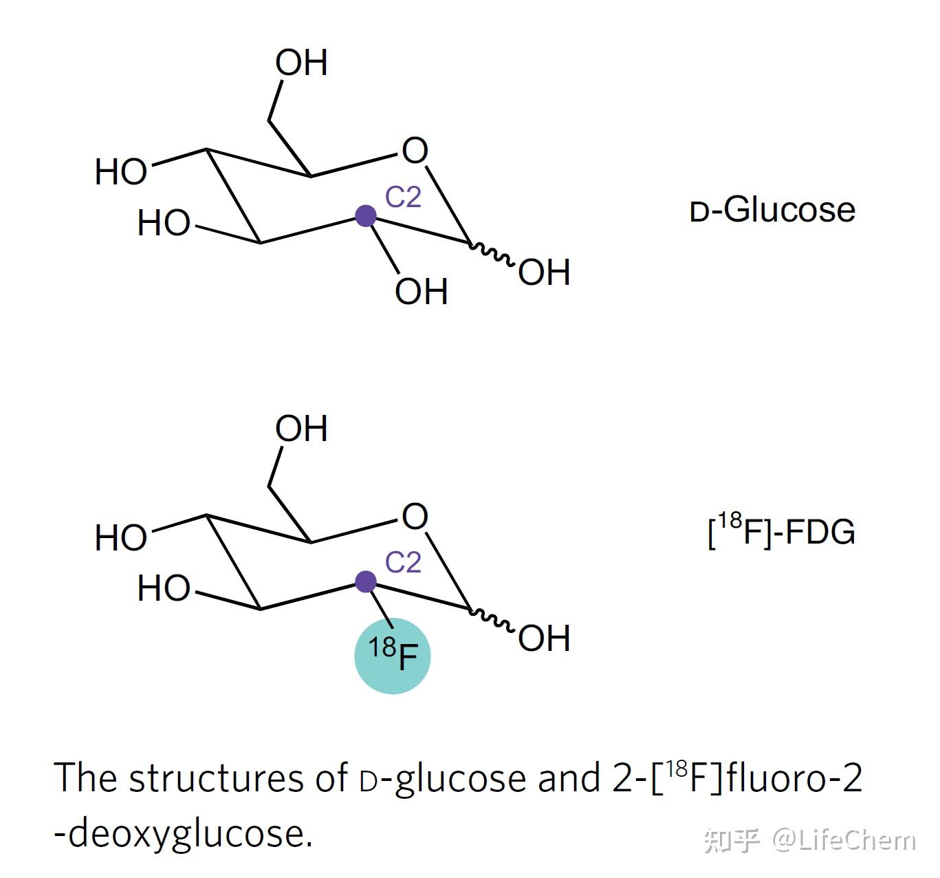 放射性葡萄糖2氟182脱氧葡萄糖