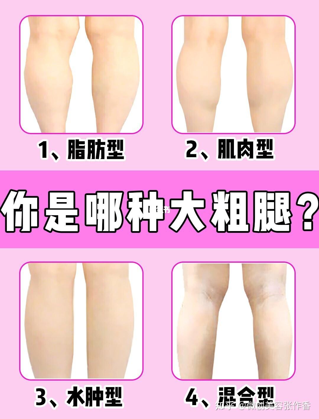 求求这种小腿外翻内八,大腿特粗外扩怎么办啊?