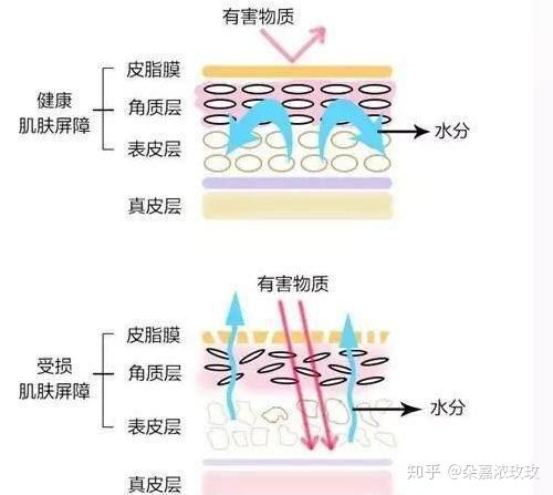 皮肤怎么样才算屏障受损 v2-9a3dd7e7b279abb95ba0c21cf1d18fac_r.jpg