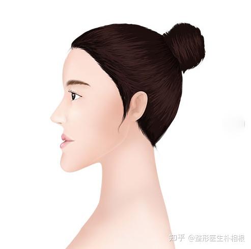 下巴特别翘怎么办