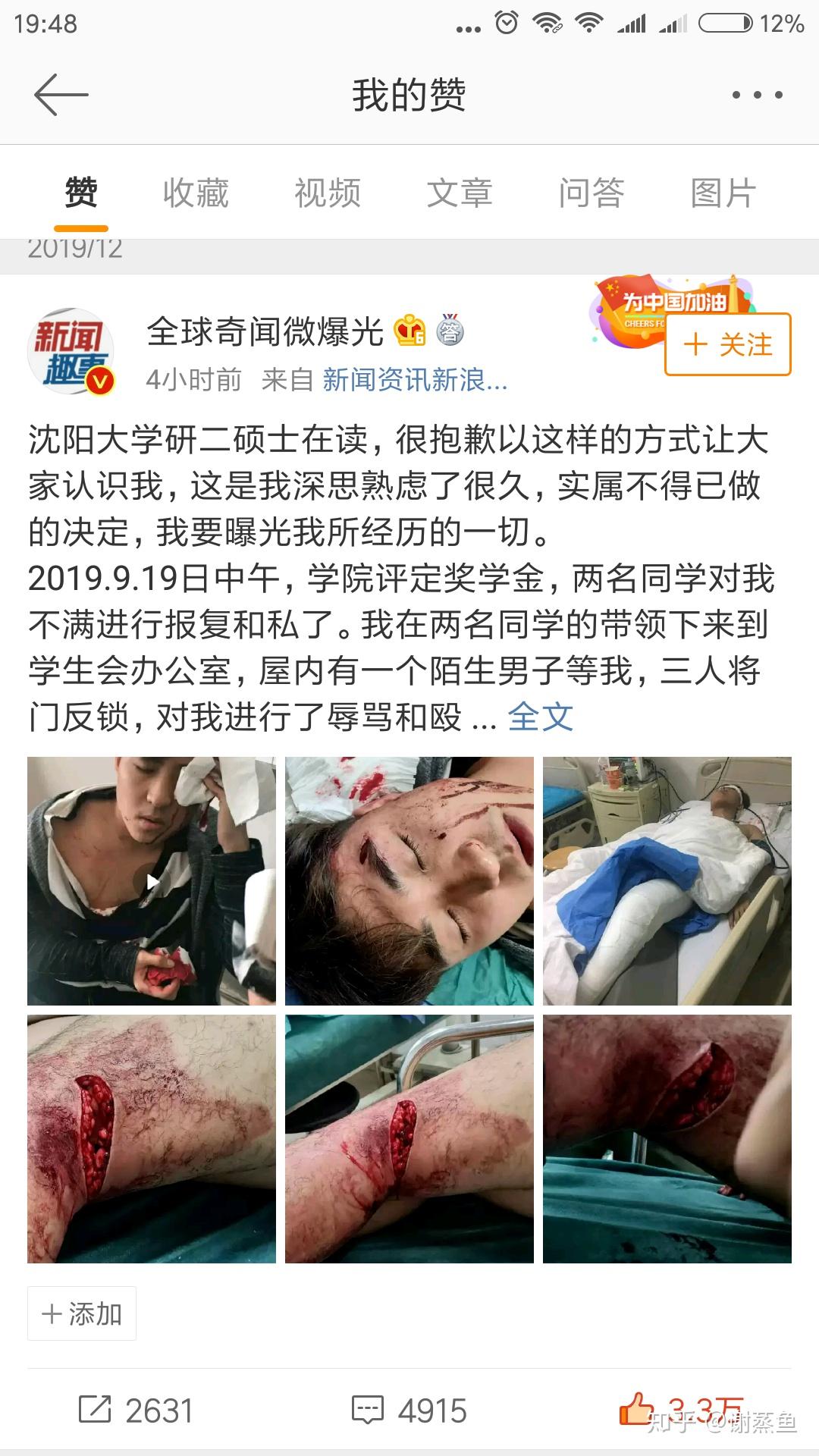 沈阳大学研究生因奖学金被捅确立为刑事案件后的两个月沈阳公安都做了