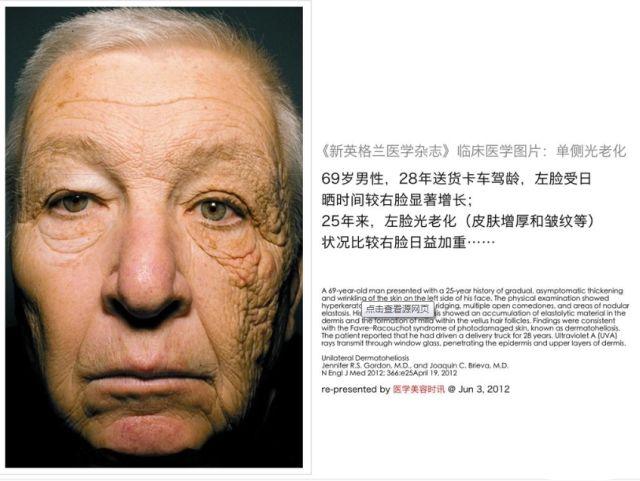 v2-9a733520bb391b6003a0fc78f2e6a38c_r.jpg