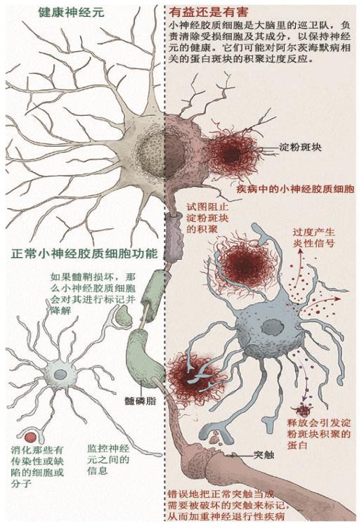 脑部炎症和小胶质细胞激活被认为与许多与认知障碍相关的疾病有关,如