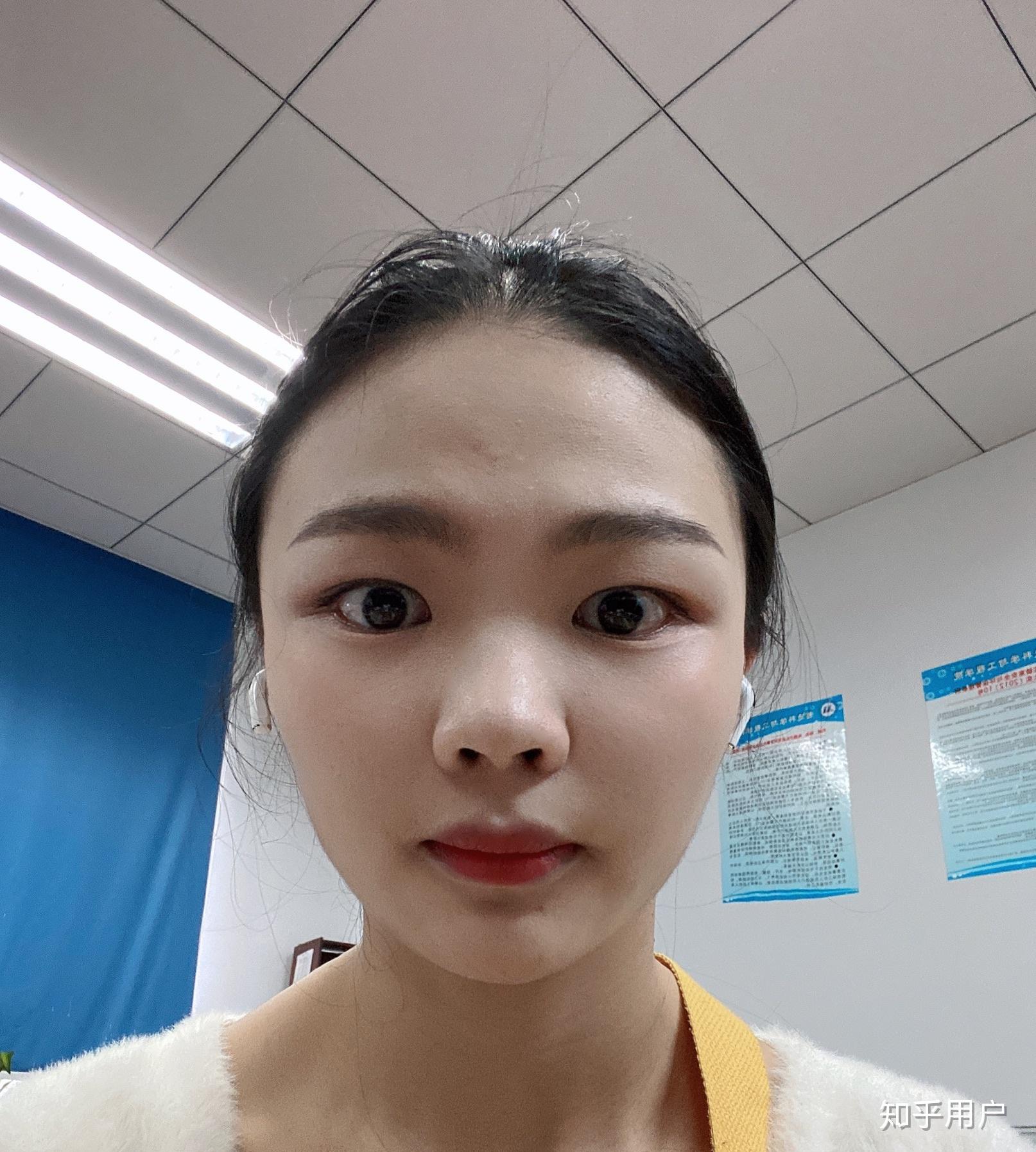 没有鼻梁鼻子塌的人是什么体验