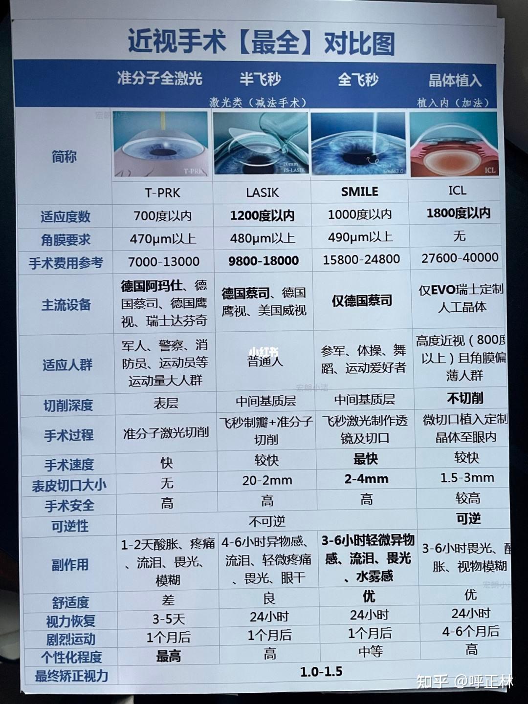 近视手术全飞和半飞如何抉择