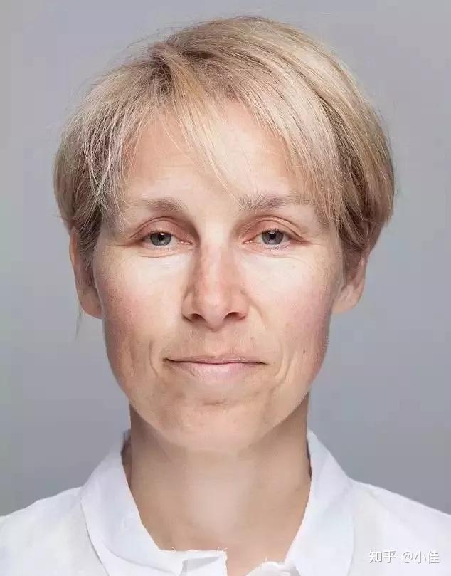 熬夜消得人憔悴伊人长斑变胖又疲惫