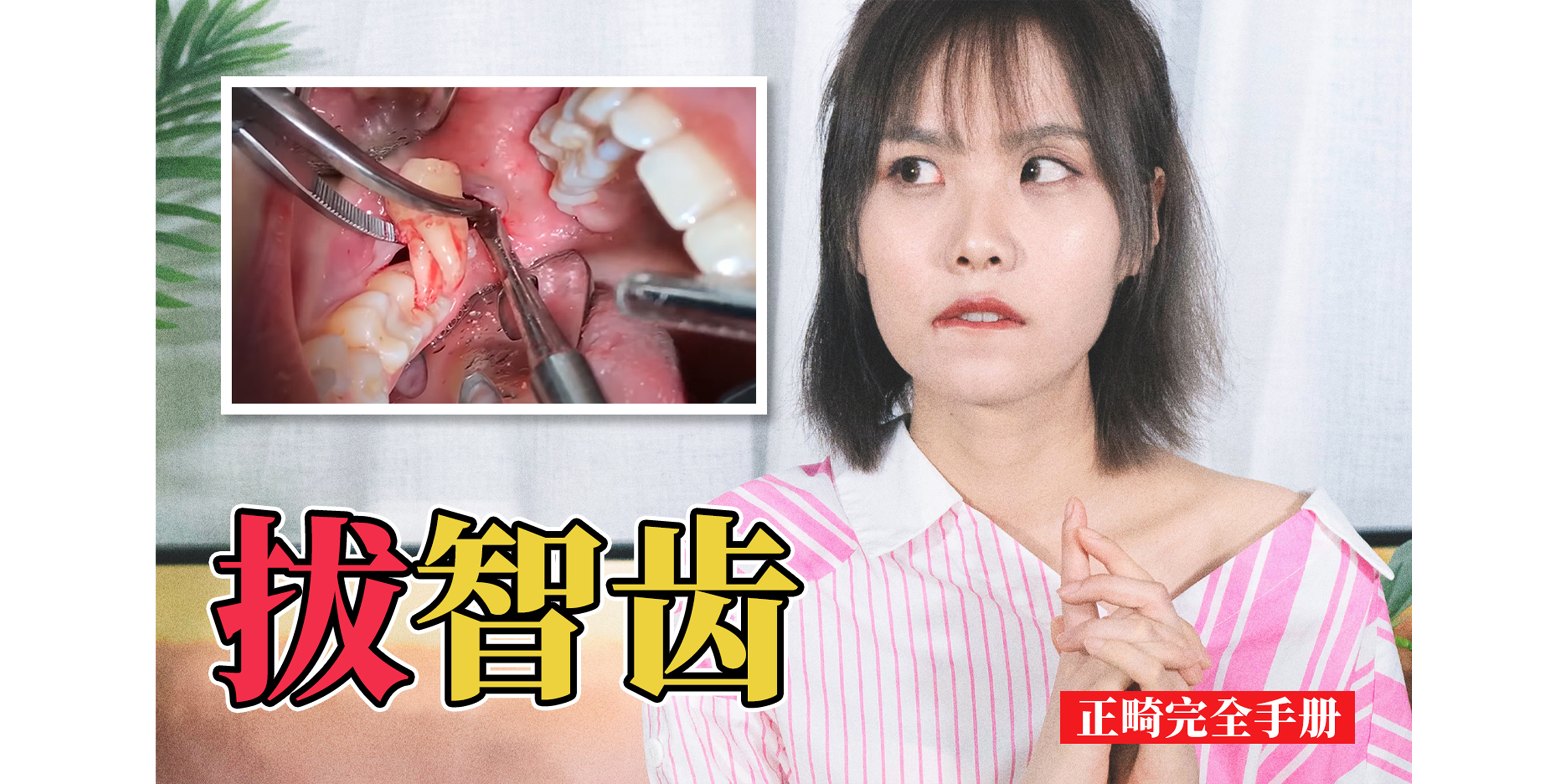 拔智齿可以瘦脸想瘦脸真的不建议取颊脂肪垫