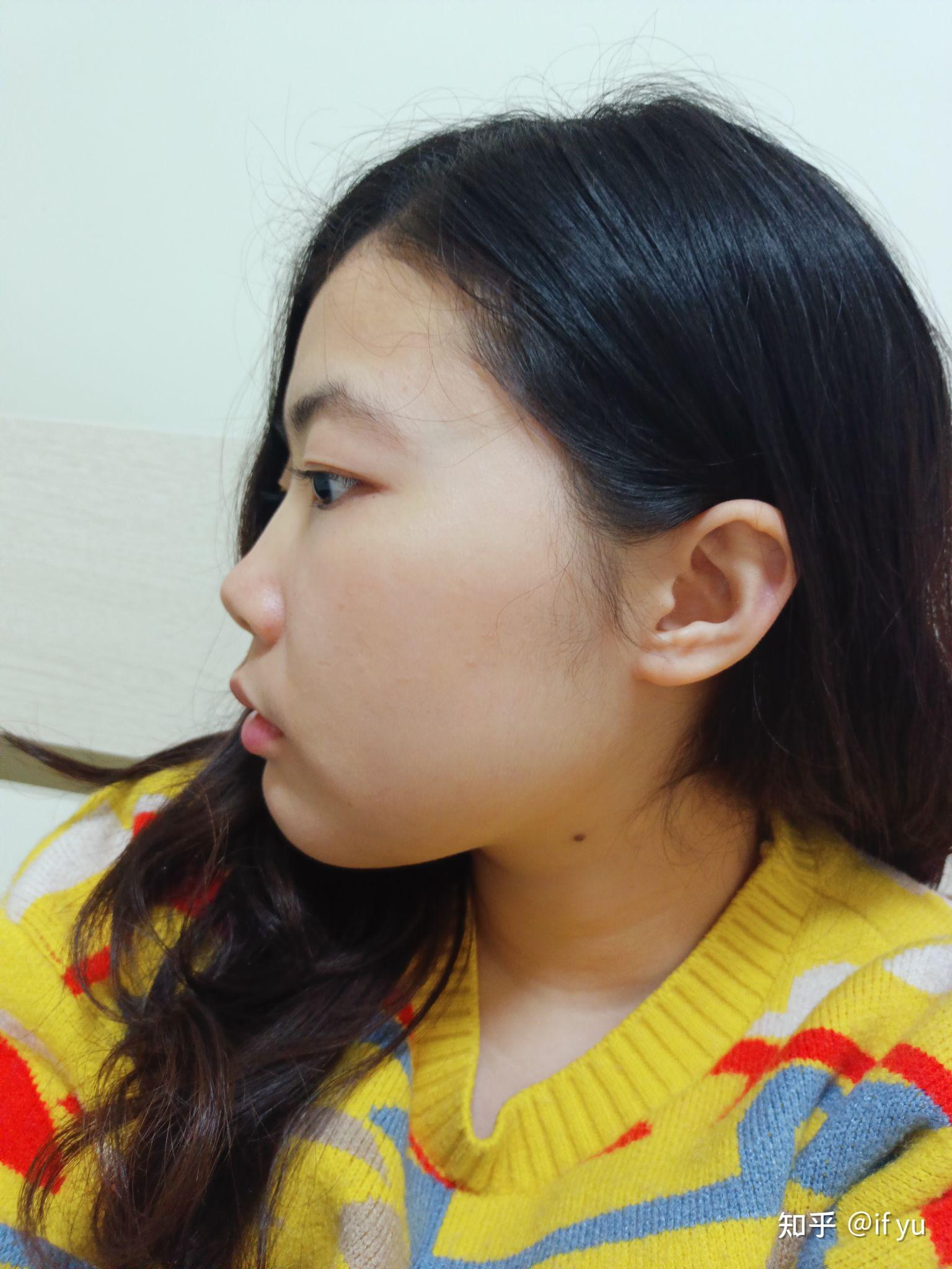正脸好看但侧脸丑到爆是种怎样的体验? - 知乎