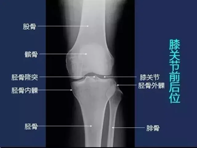 膝盖的结构图 名称图片