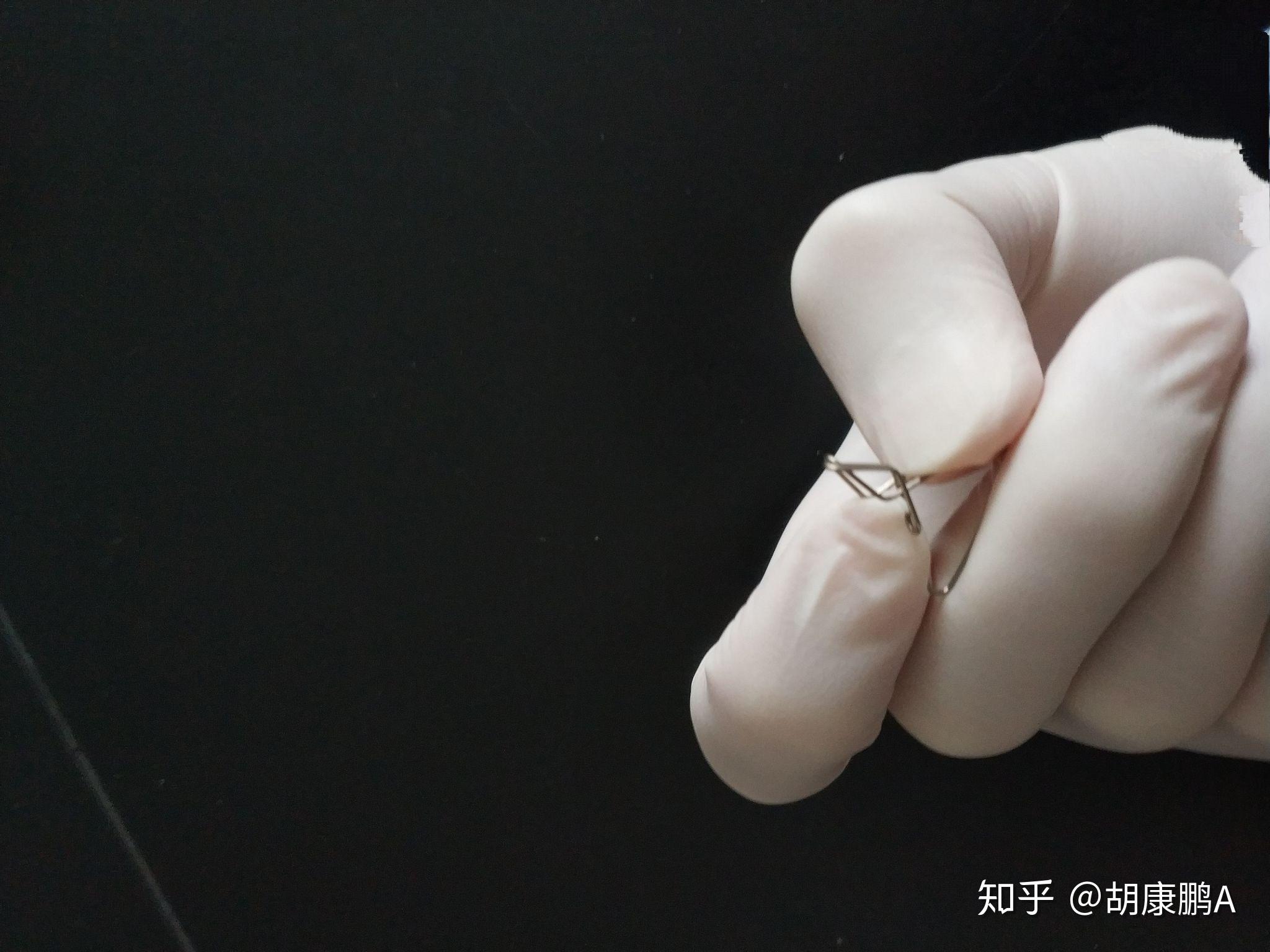 爱阔尔达包茎扩张器温和扩开包皮口,改写手术指征,可以大幅降低包皮环