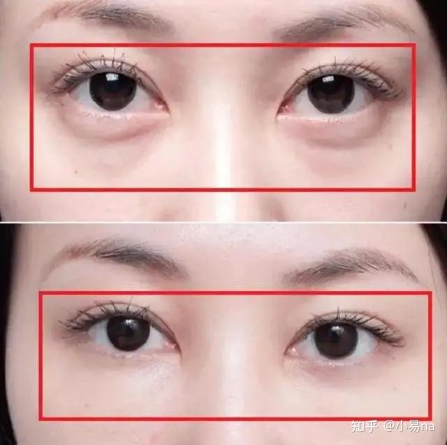 20岁/30岁/40岁眼霜推荐!