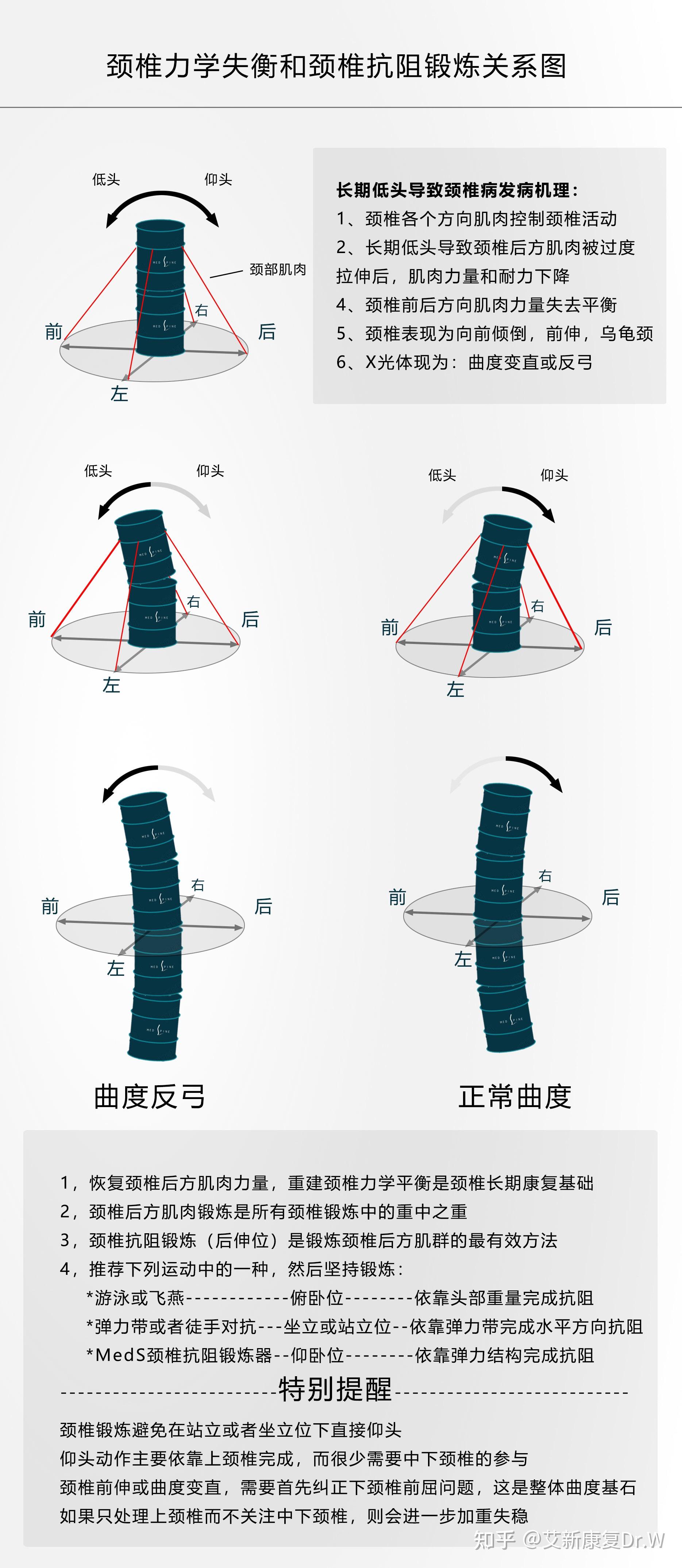 颈椎反弓究竟是什么? - 知乎