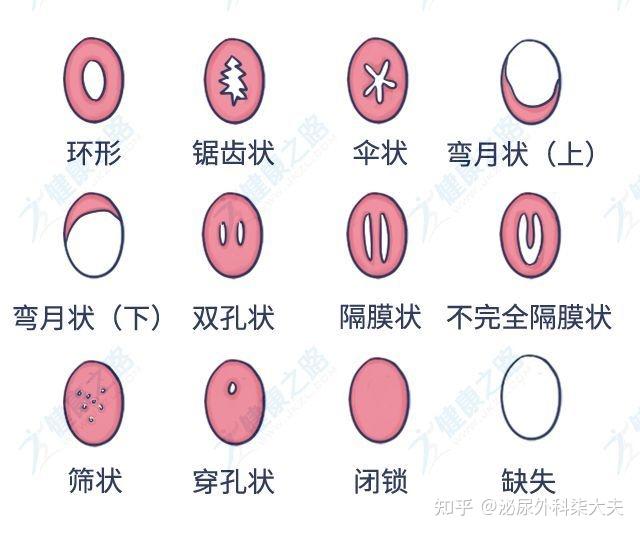 总是因为太疼进不去,是我有问题吗? - 知乎