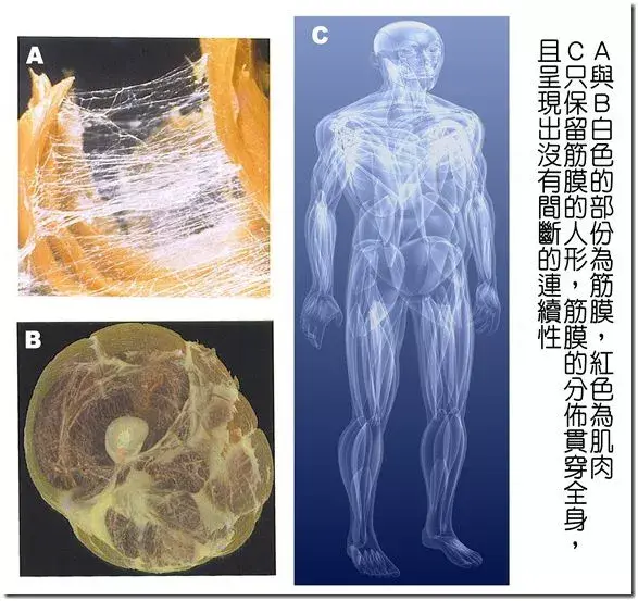 如果肌纖維的攣縮結節引起筋膜張力變化或部筋膜產生損傷或炎症,粘連