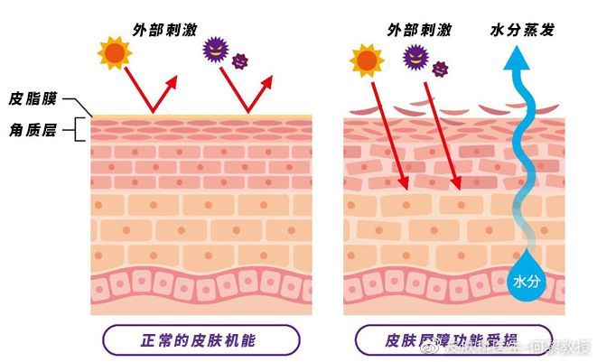 皮肤屏障是什么？你都了解吗？ - 知乎