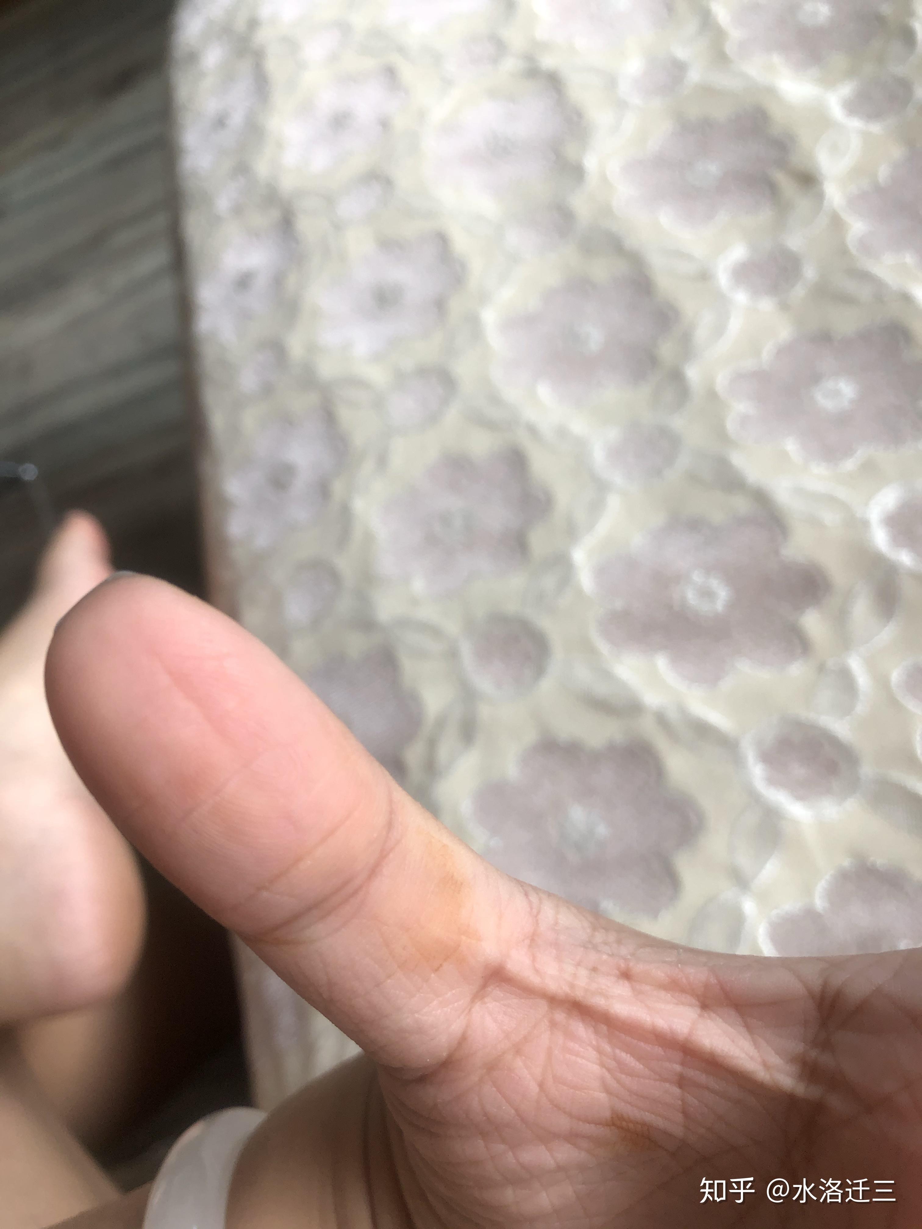 一觉醒来手上有铁锈一般的黄色块洗不掉