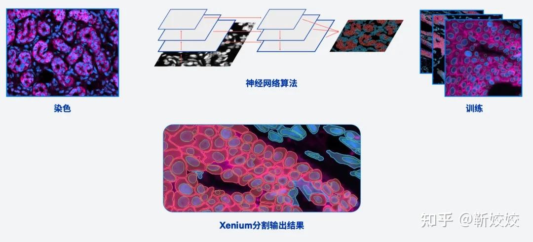 突破!10x Xenium技术基因原位检测新高度空间生物学文章大爆发? - 知乎