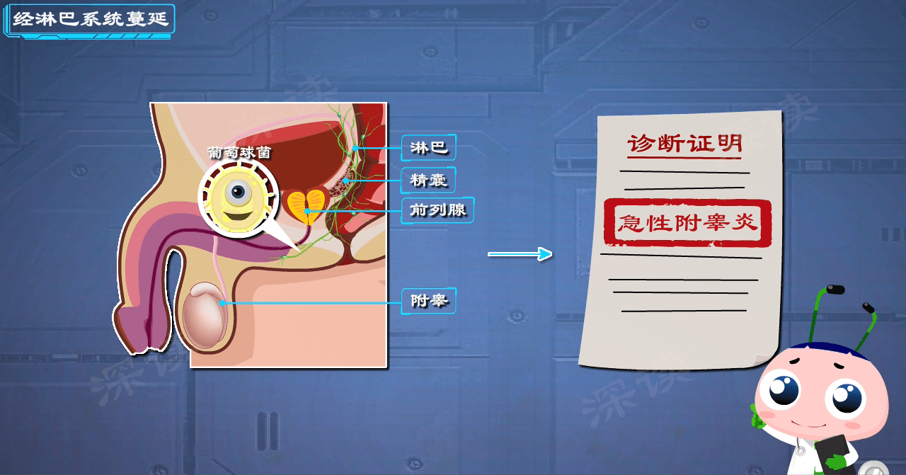 附睾炎是因私生活乱?躲开附睾炎就得做好这三点