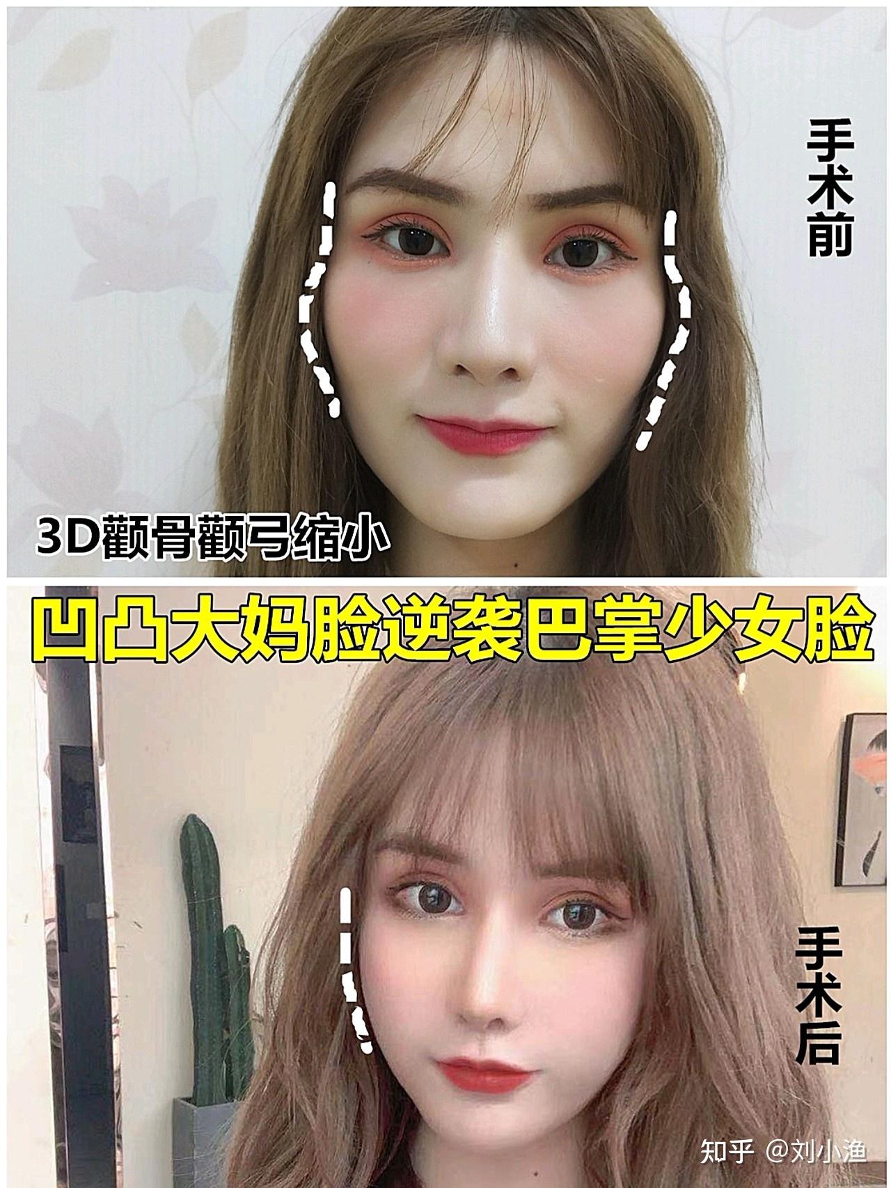 额头窄颧骨有点高脸型较宽大怎么弄