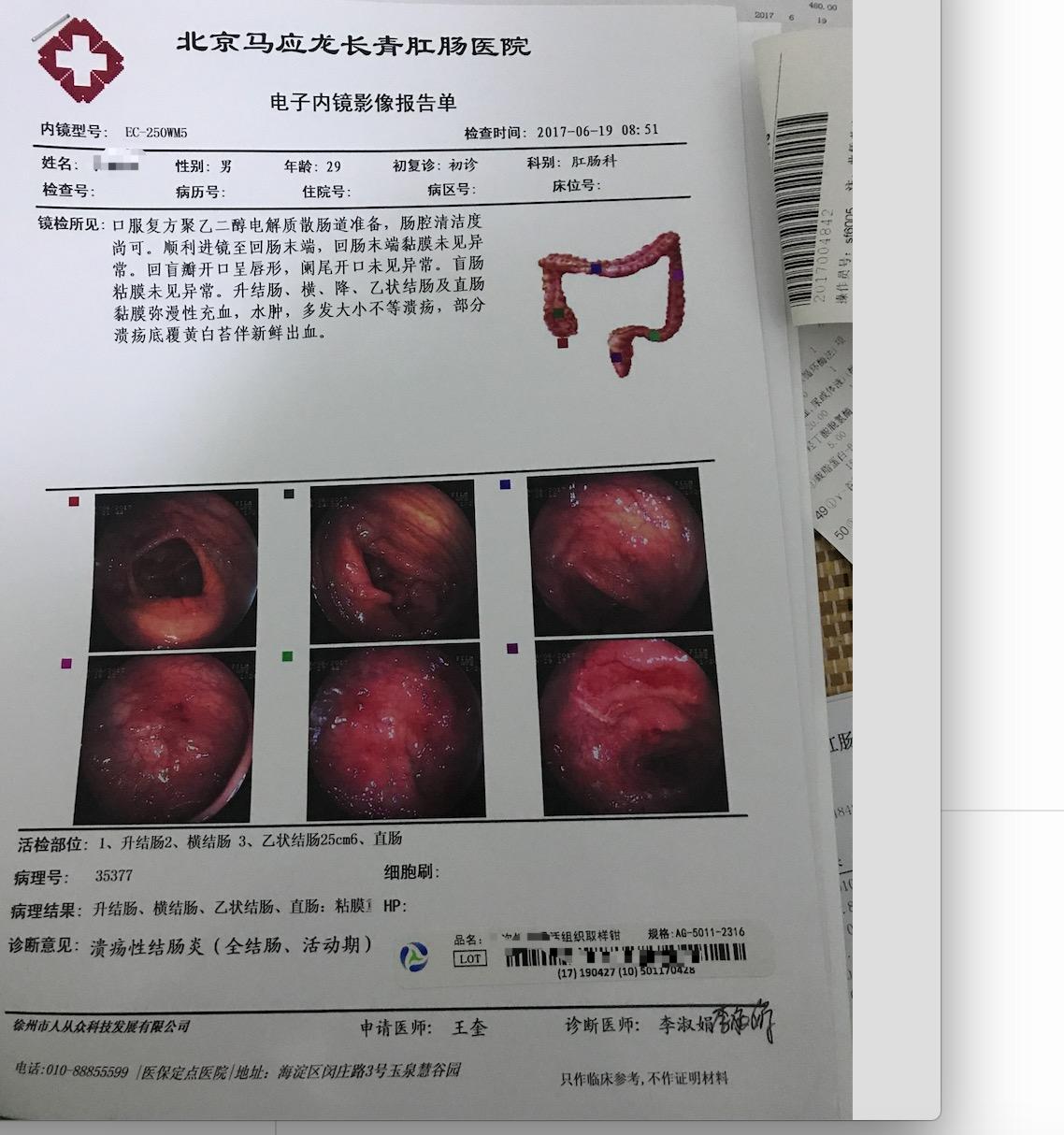 全结肠切除和永久性回肠造口术 - 外科手术学 - 天山医学院