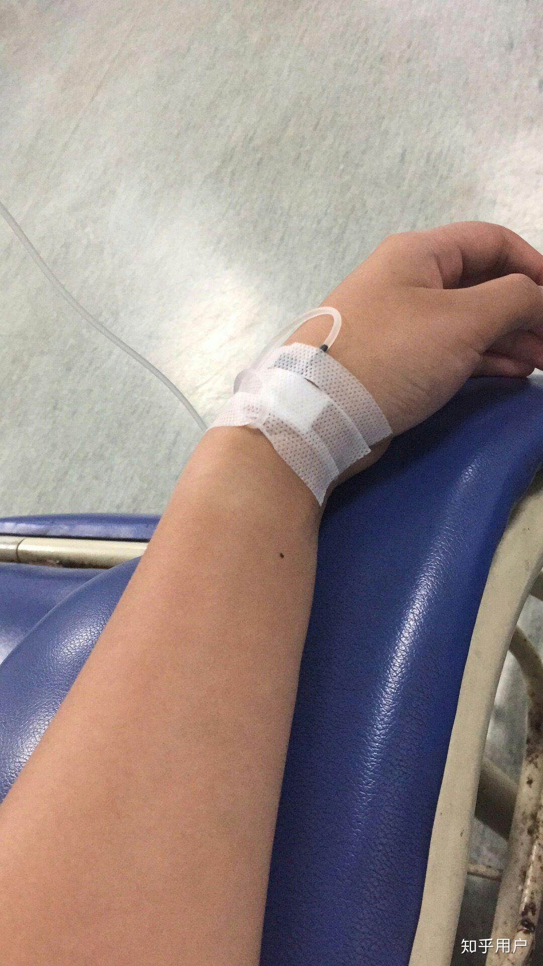 有没有输液的照片我给老师请的病假她要我发照片给她