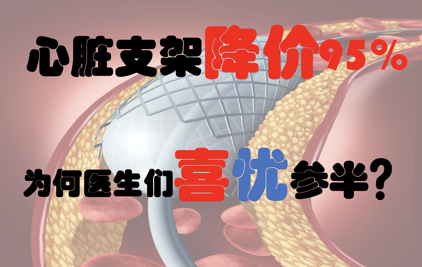 心脏支架大降价,便宜还得有好货