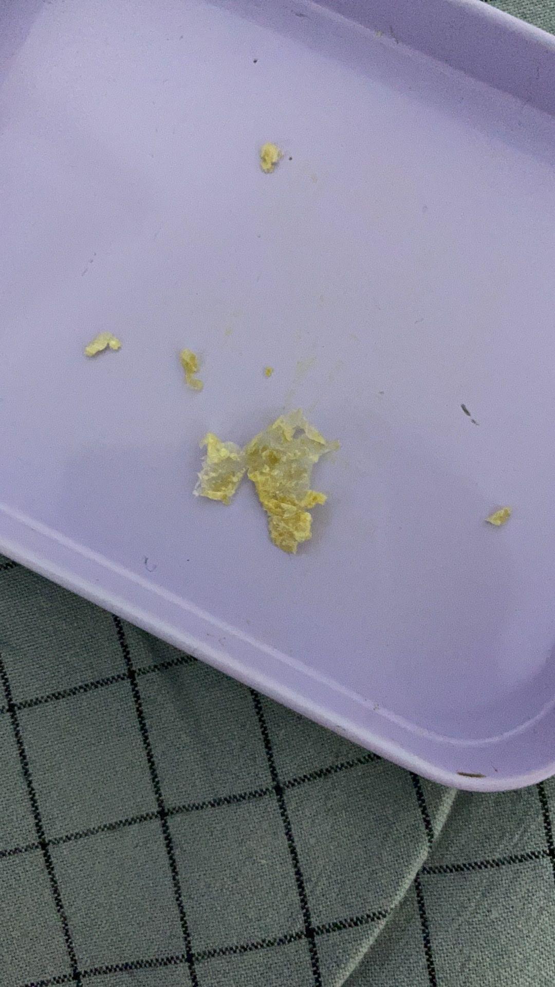 为什么我从来没掏出来过大号的耳耵聍? - 知乎