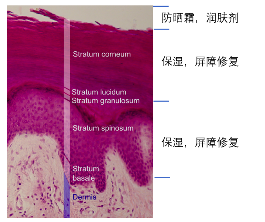 图表 2 皮肤切片(根据维基百科图片重新标注)