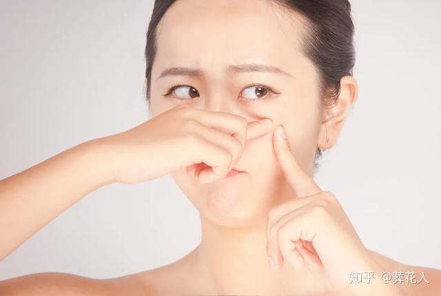 痤疮常用治疗方法