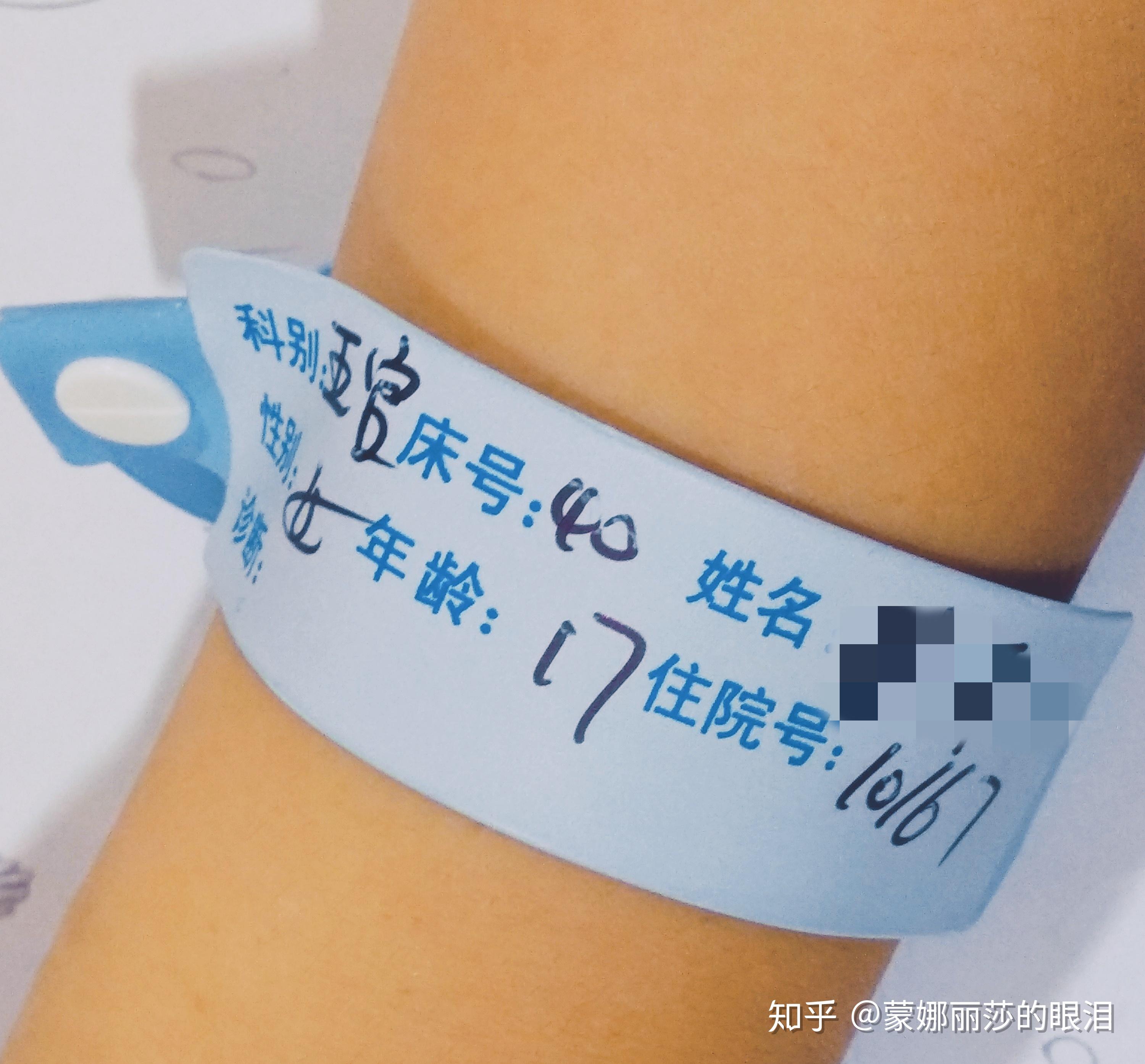 做鼻中隔偏曲手术体验①