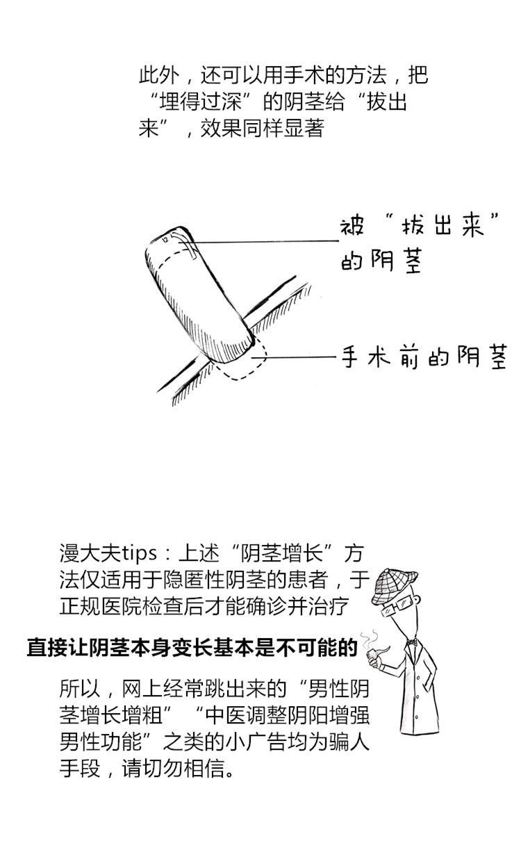 男性阴茎增大增粗的方法