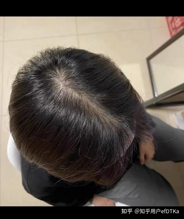 这是一个生发的过程。 - 知乎