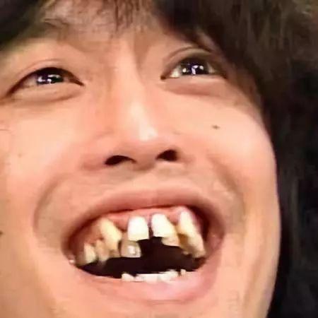 为什么日本人的牙齿这么丑?