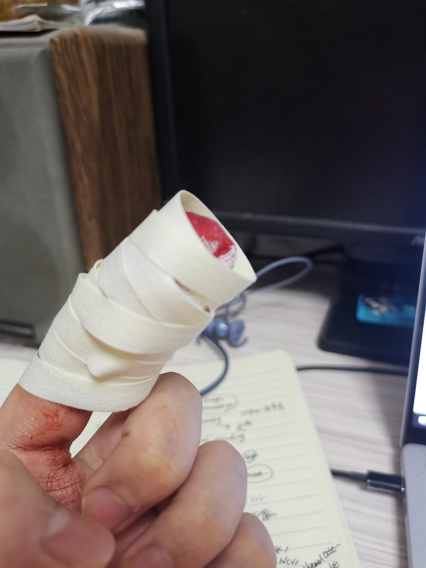 食指被菜刀侧切指甲肉都掉了恢复记录