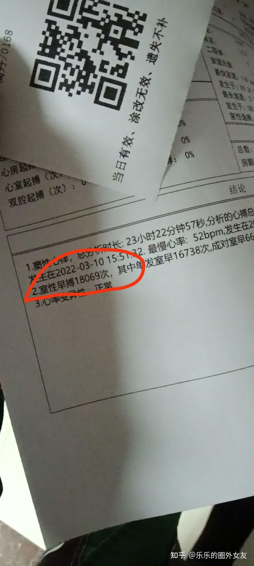你是怎么检查出抑郁症的?