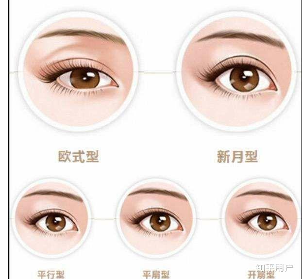 内双和外双的区别是什么?因为有人告诉我,双眼皮的褶皱和眼角有交点就是内双,无论你的双眼皮多宽? - 知乎
