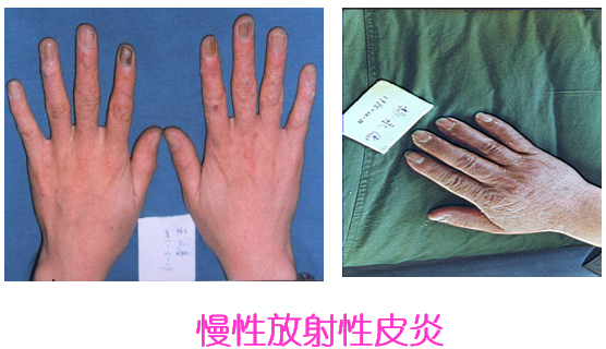 大连机场查出某旅客佩戴生命能量石核辐射超标112倍常