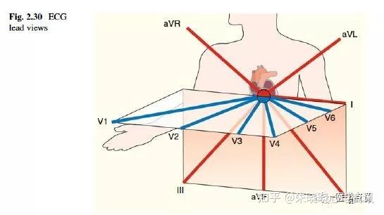 15导心电图位置图片图片