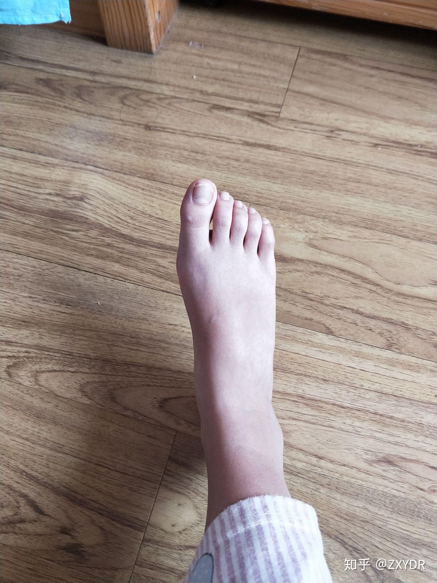 女孩子有一双好看的脚丫是一种什么样的体验